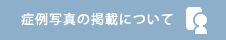 症例写真の掲載について