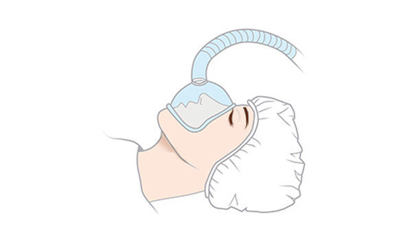 鼻中隔延長の手術方法 STEP1