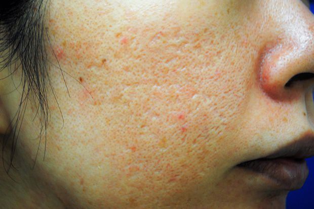 医師の診察を受ける時期