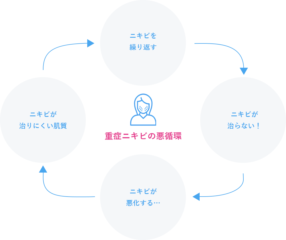 重症ニキビの悪循環 ニキビを繰り返す ニキビが治らない！ ニキビが悪化する… ニキビが治りにくい肌質