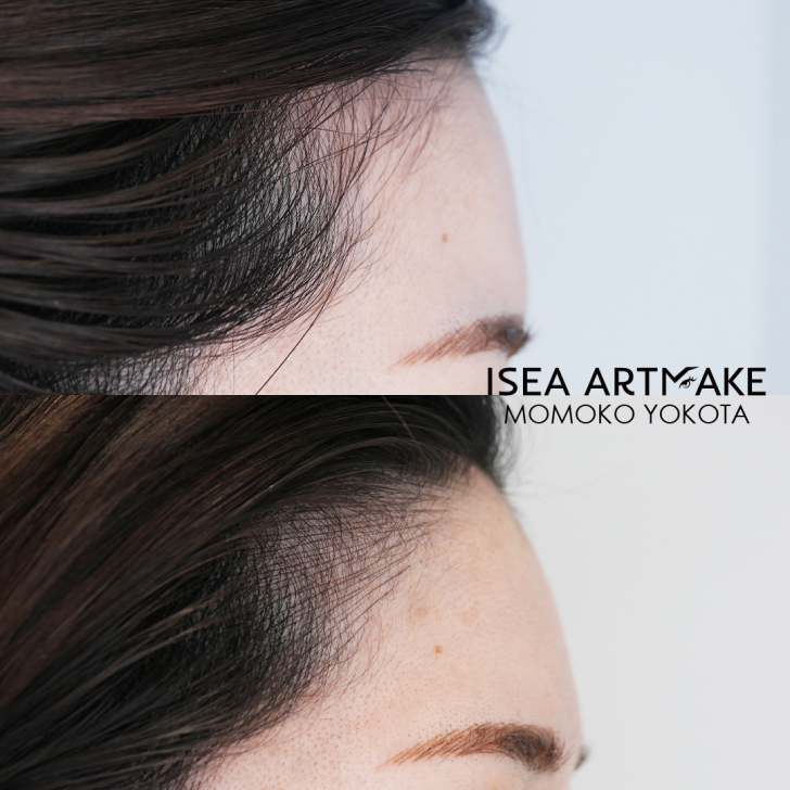 ヘアライン正面 サイド Yokota S Portfolio 横田桃子のアートメイク症例写真
