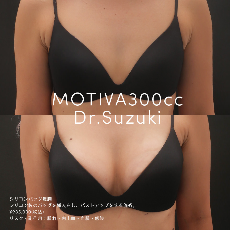 MOTIVA 300CC Dr SUZUKI