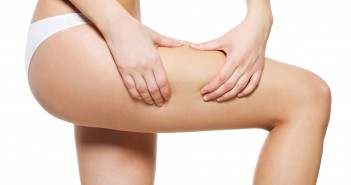 Female squeezes cellulite skin on her legs - close-up shot on white background