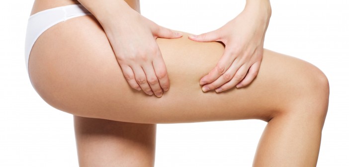 Female squeezes cellulite skin on her legs - close-up shot on white background