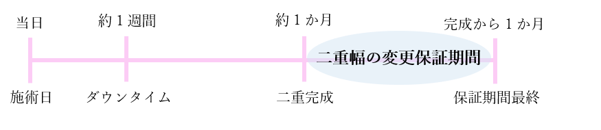 埋没法　保証