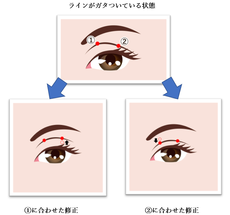 二重ガタツキの修正