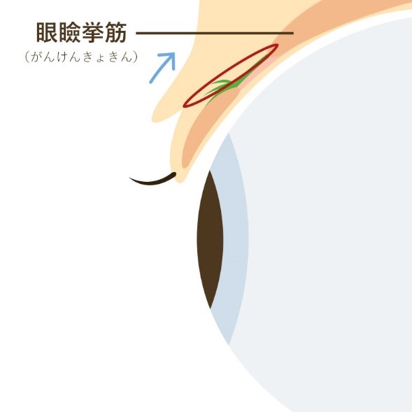 眼瞼挙筋