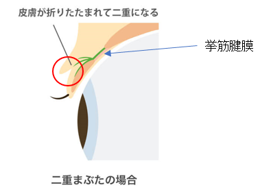 挙筋腱膜１