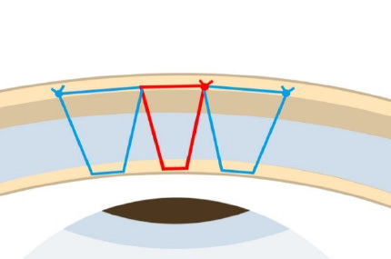 埋没法プレミアム