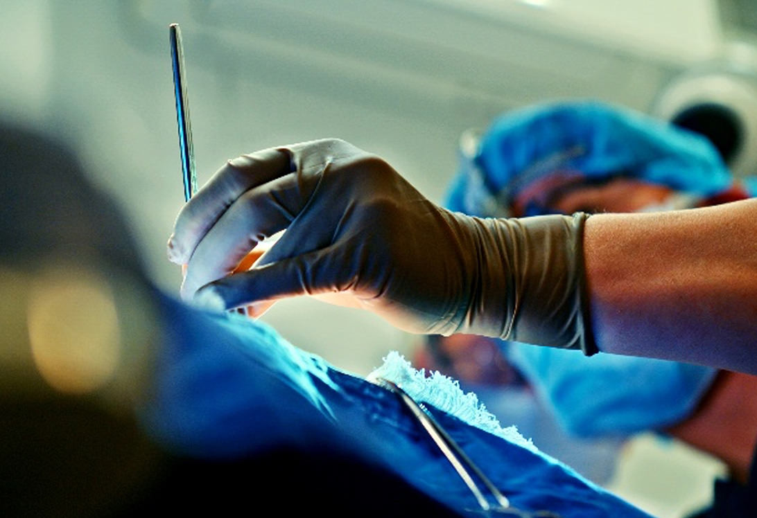 切開法まで熟知した医師が執刀