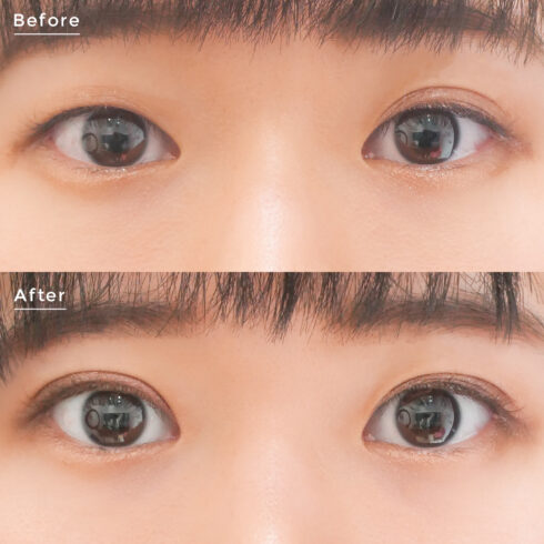 大山希里子医師 症例写真