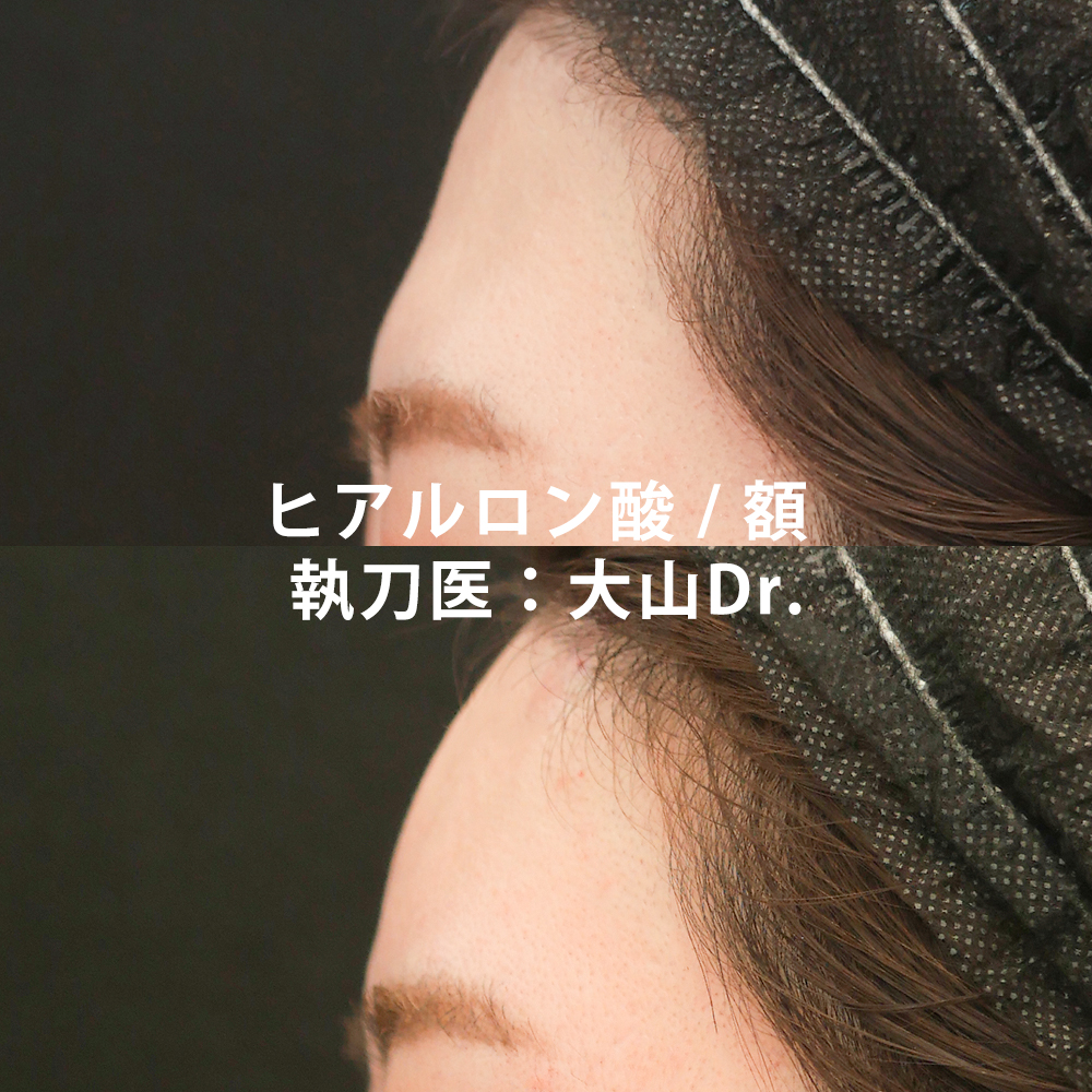 大山医師の症例写真