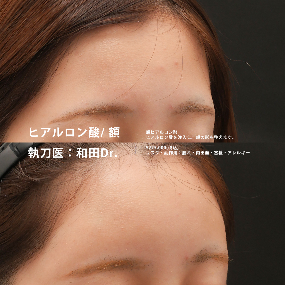 和田医師のその他の症例