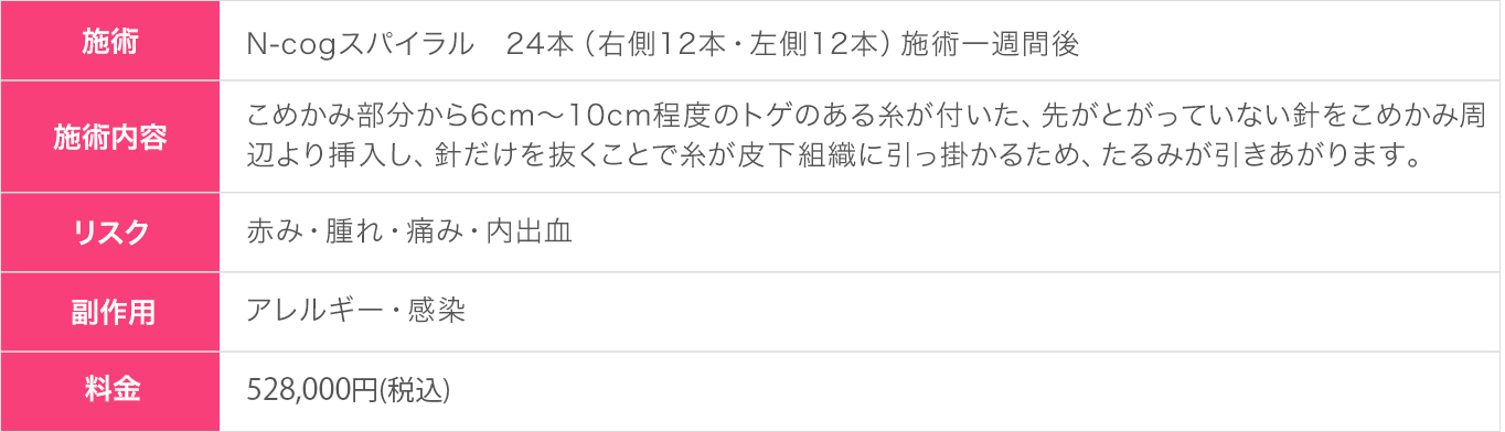 N-cogスパイラル1週間後(30代|女性)