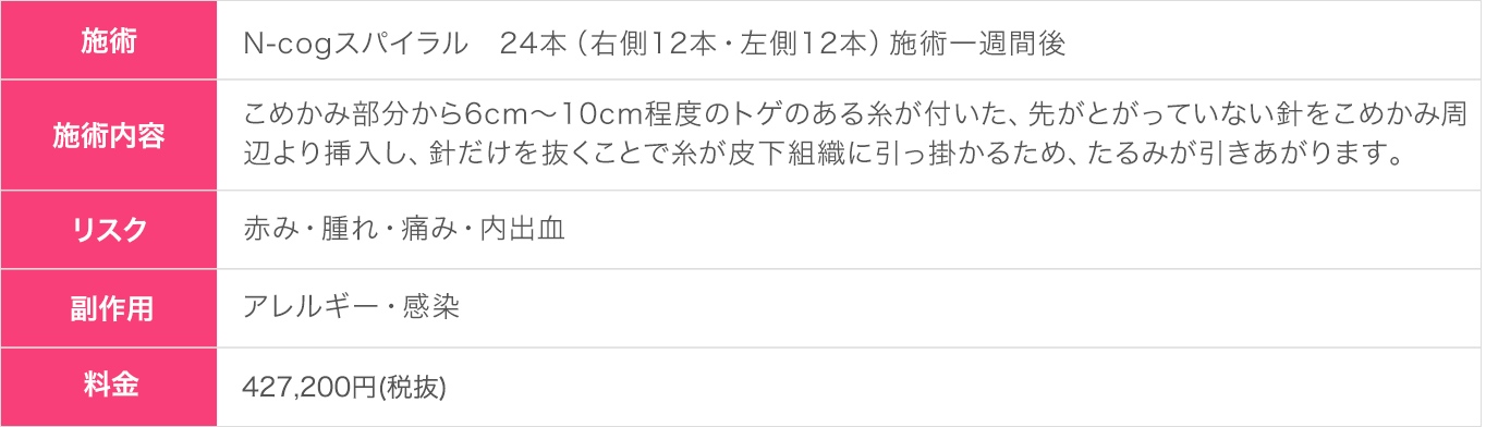 N-cogスパイラル1週間後(30代|女性)