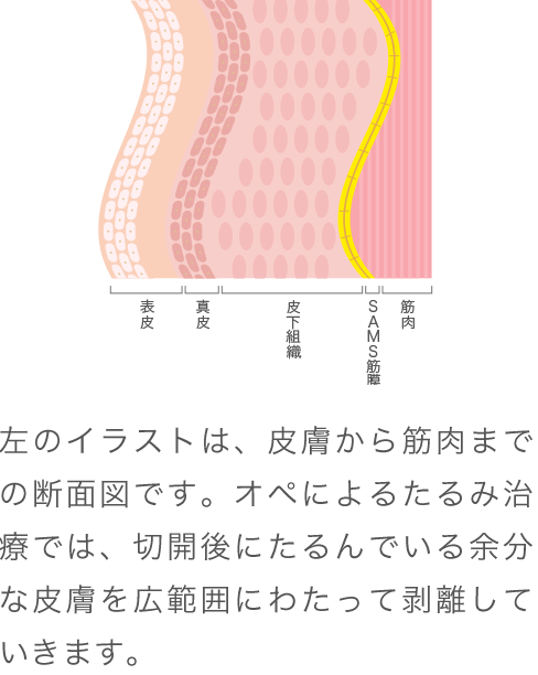 フェイスリフトなら形成外科医が施術する美容外科で リフトアップ たるみ治療 なら東京イセアクリニック