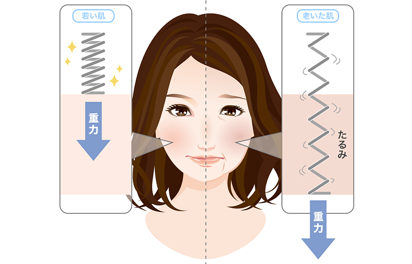 高密度焦点式超音波（HIFU）とは