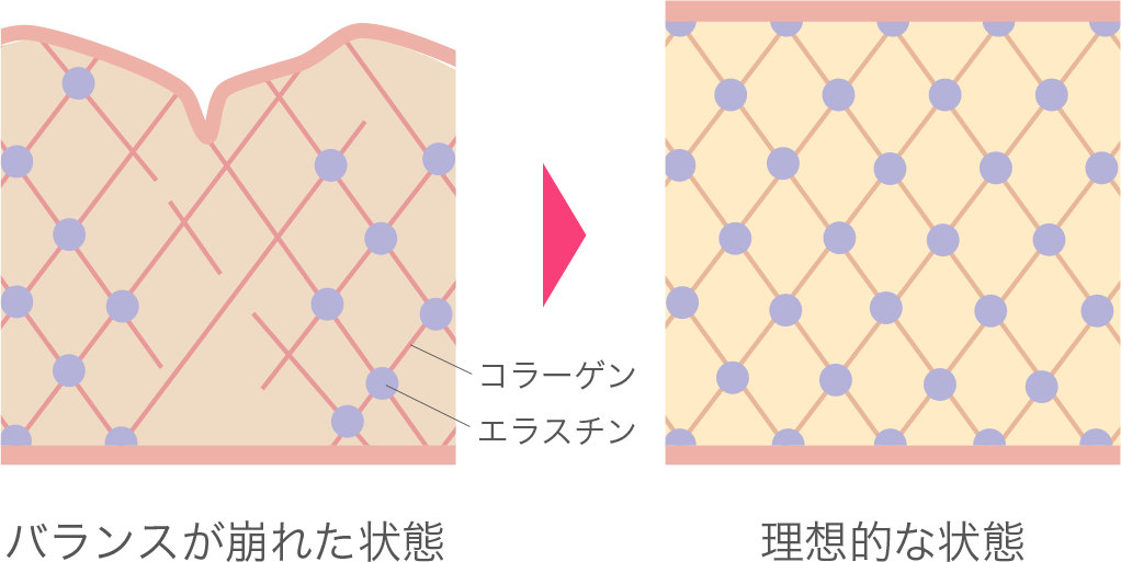 【1.5mm】のトランスデューサー