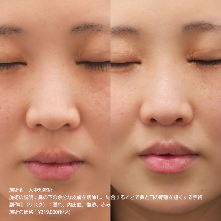 手到病自除 Amazon.com: 手到病除6招搞定: 9787534172731: 范炳华汪芳俊王浩