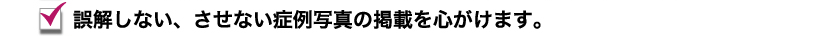 誤解しない、させない症例写真の掲載を心がけます。