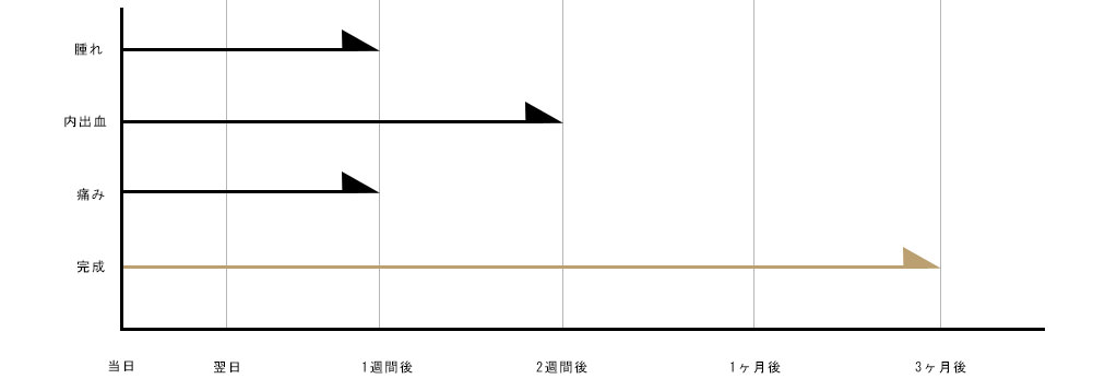 ダウンタイムについて