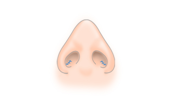 STEP3
