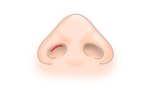 STEP2
