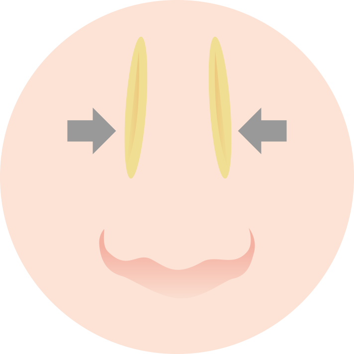 プロテーゼとは