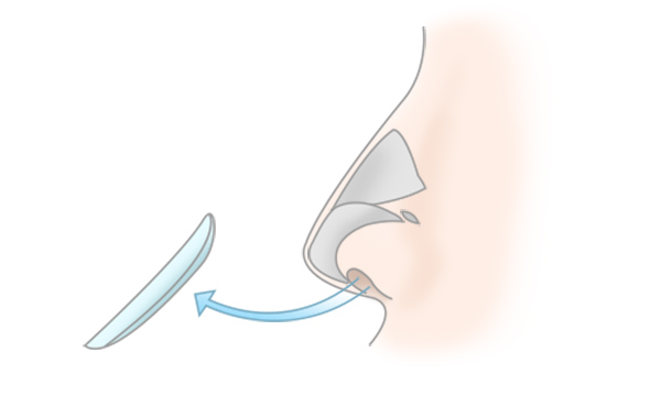 STEP3