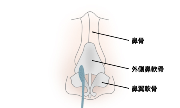 わし鼻修正・鼻骨削りの手術方法 STEP3