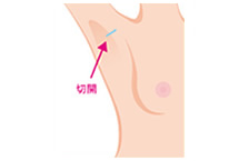 施術方法