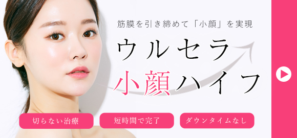 ウルセラ小顔ハイフ