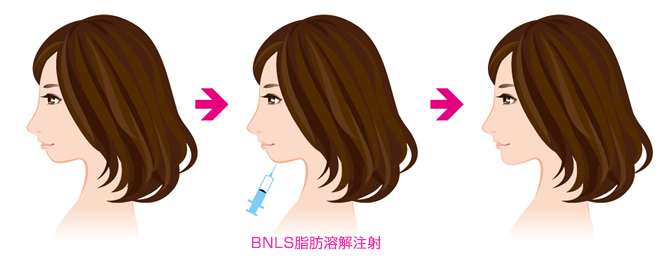 BNLS
