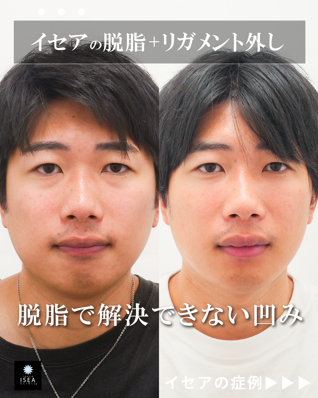 権東容秀医師 症例