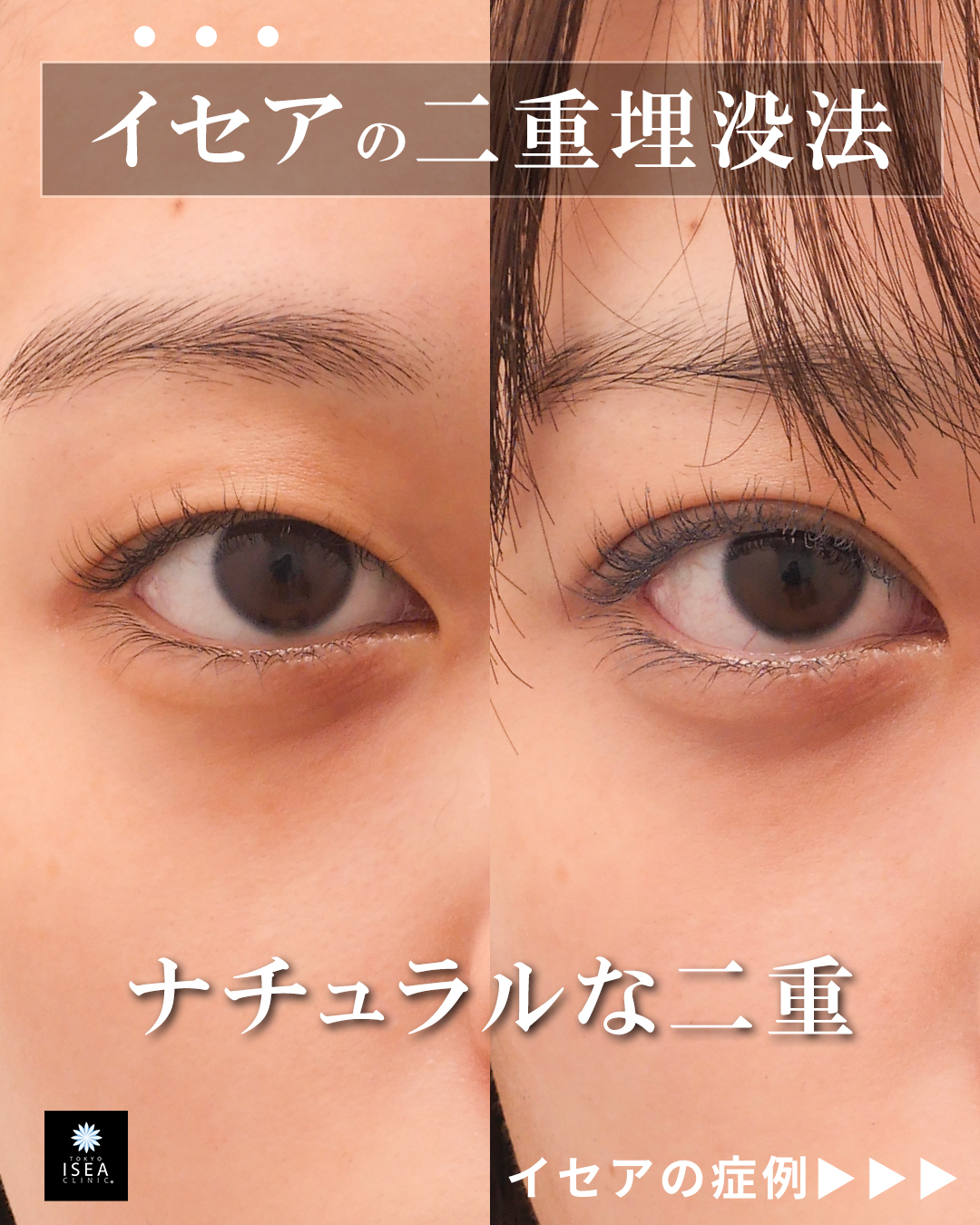 権東容秀医師 症例