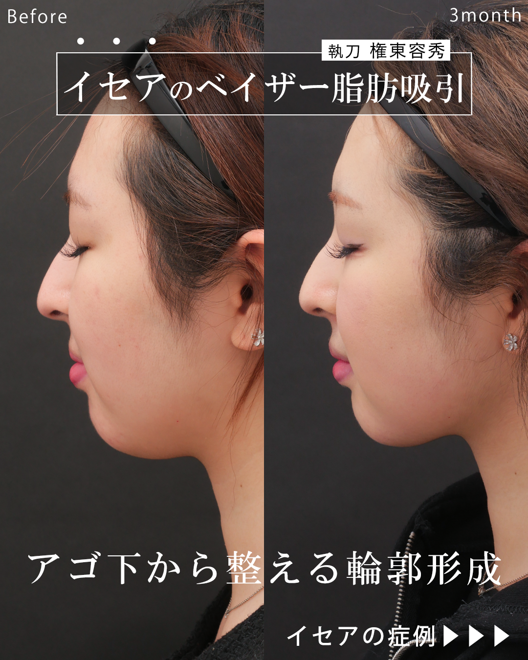 権東容秀医師 症例