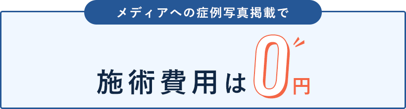 施術費用は0円