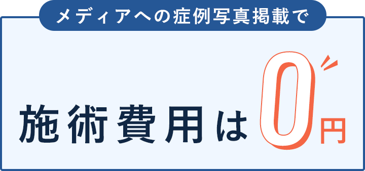 施術費用は0円