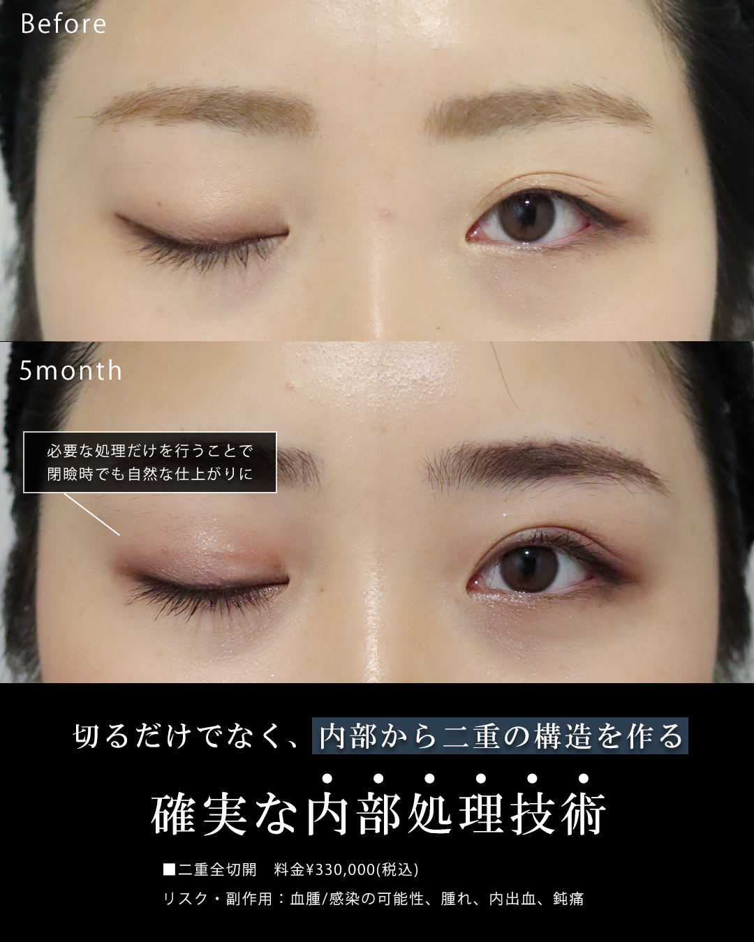 吉種克之医師 症例