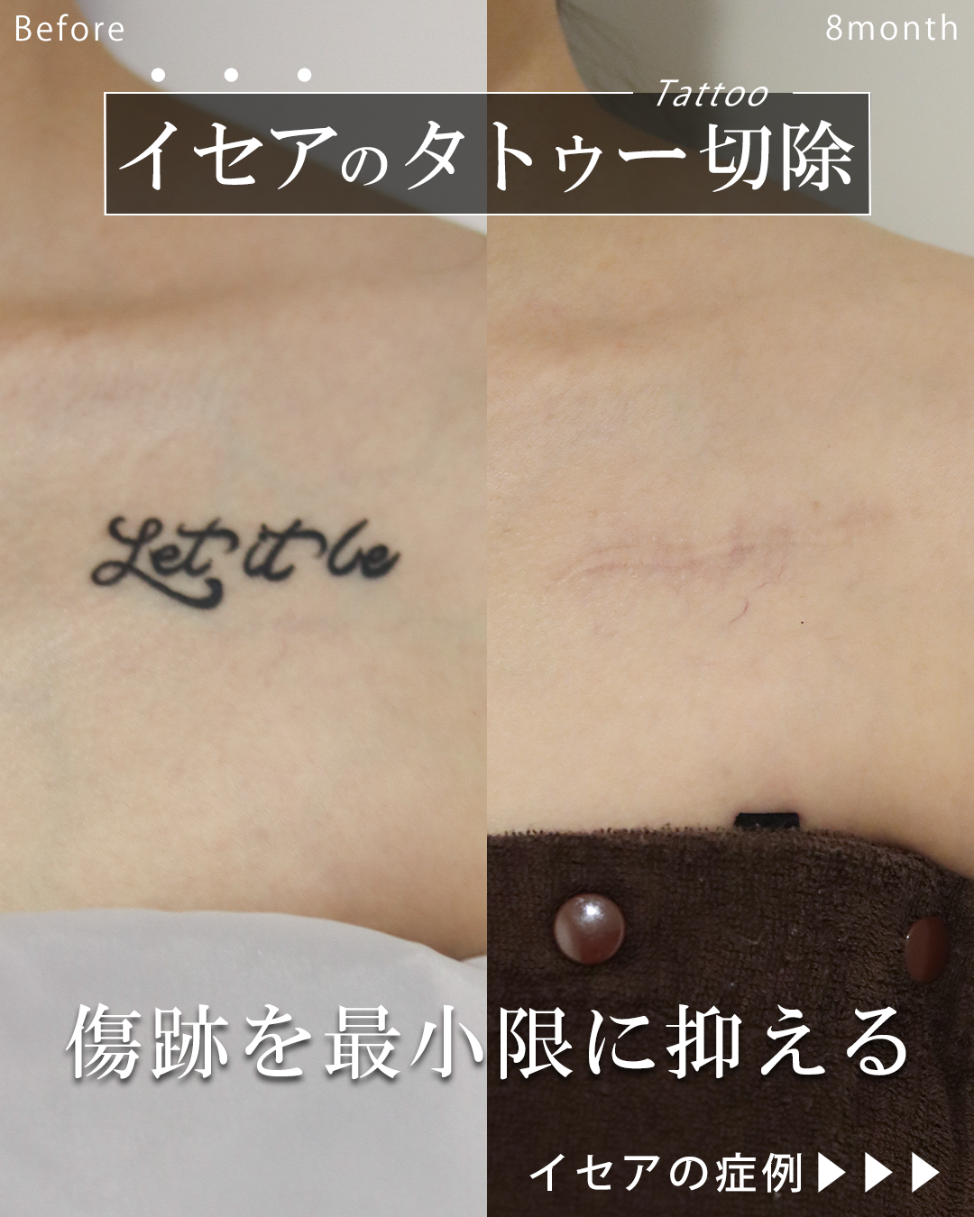 吉種克之医師 症例