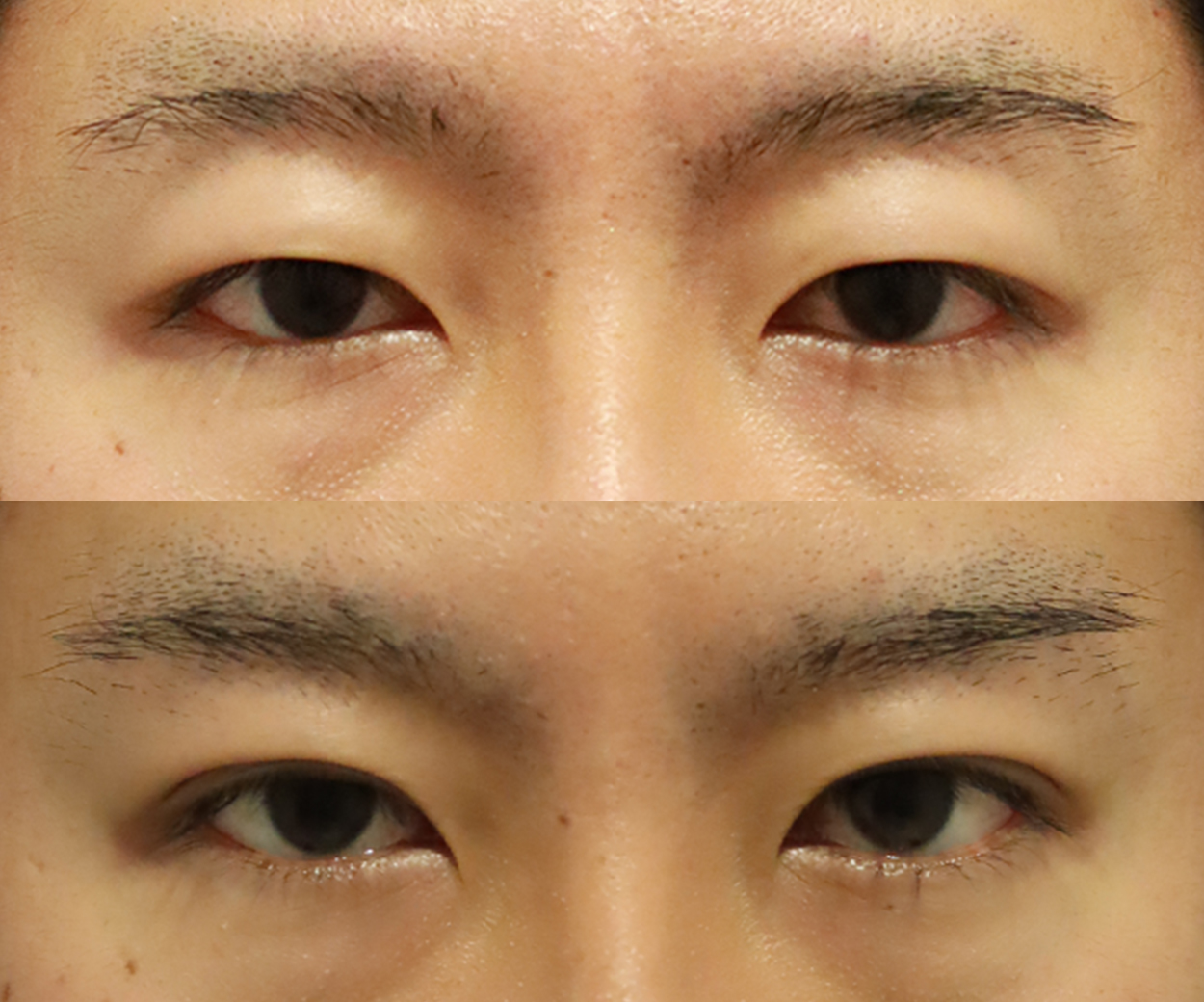 顔バレが不安な⽅へ