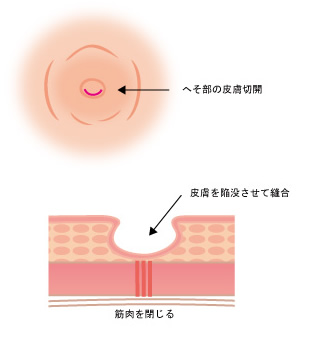 施術方法