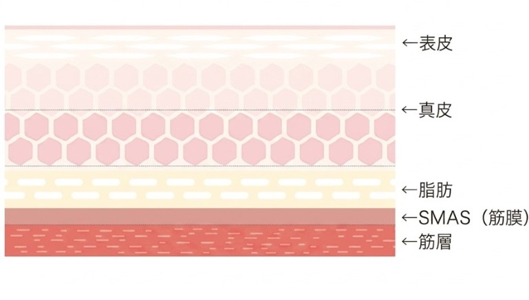 効果を実感しやすいイセア独自のプロトコル 表皮 真皮 脂肪 SMAS(筋膜) 筋層