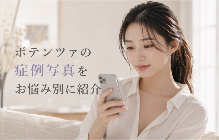 ポテンツァの症例写真をお悩み別に紹介