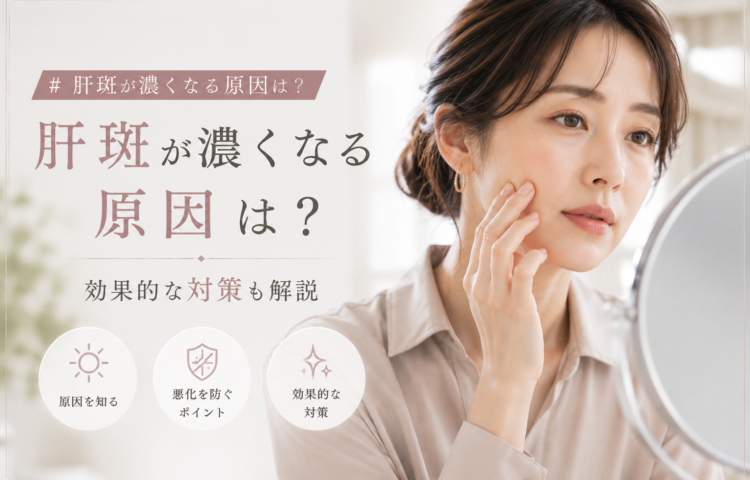 肝斑が濃くなる原因は？効果的な対策も解説