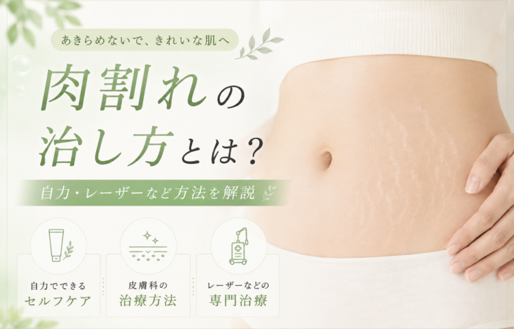 <strong>肉割れの治し方とは？自力・レーザーなど方法を解説</strong>