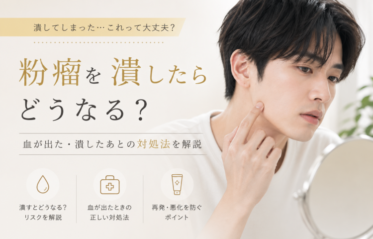 <strong>粉瘤を潰したらどうなる？血が出た・潰したあとの対処法を解説</strong>