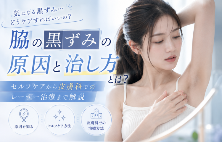 <strong>脇の黒ずみの原因と治し方とは？セルフケアから皮膚科でのレーザー治療まで解説</strong>
