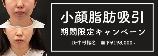 小顔脂肪吸引 限定キャンペーン Dr中村指名 顎下¥198,000〜