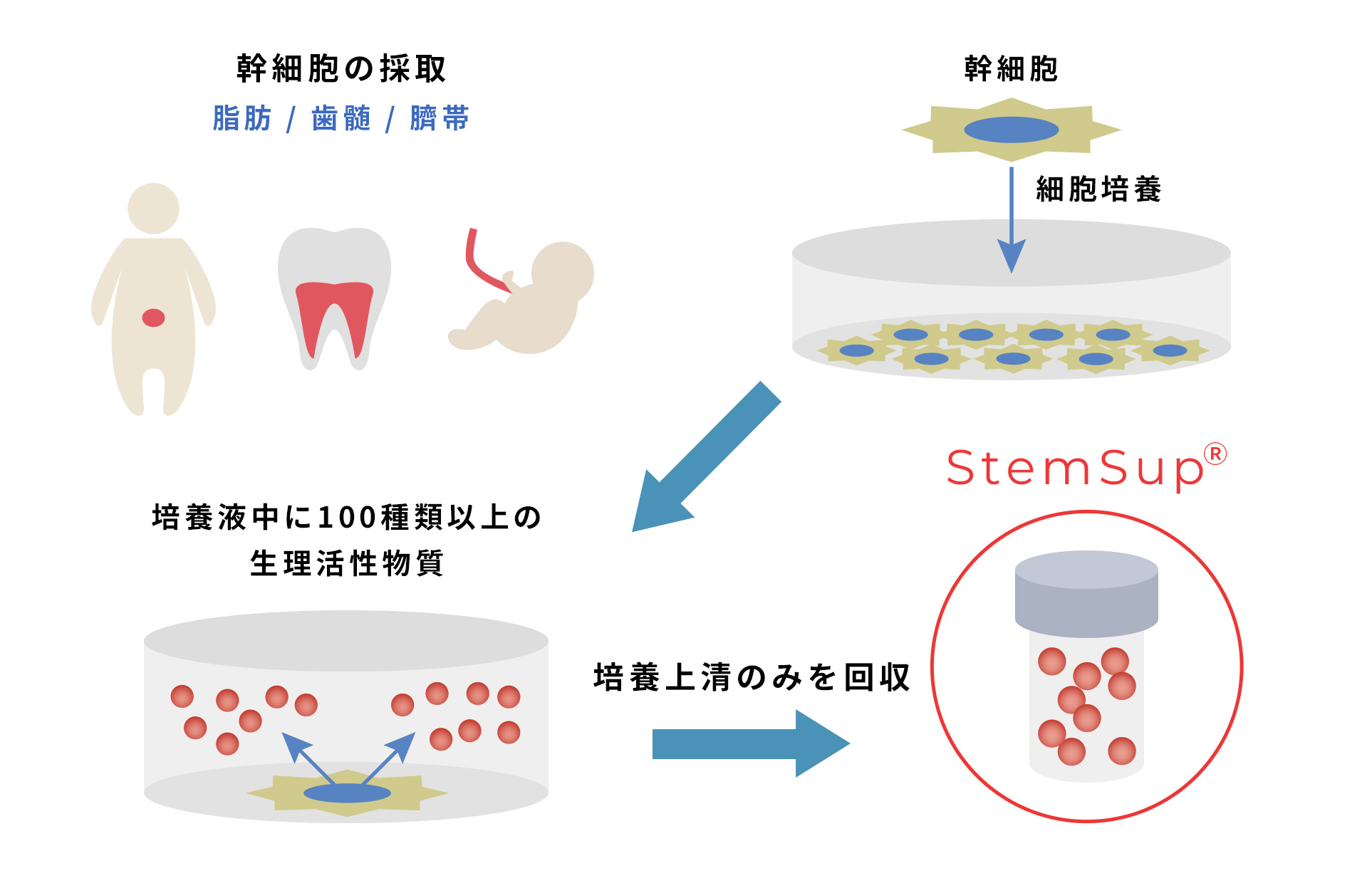 幹細胞の採取 脂肪/歯髄/臍帯 幹細胞 細胞培養 培養液中に100種類以上の生理活性物質 培養上清のみを回収 StemSupⓇ